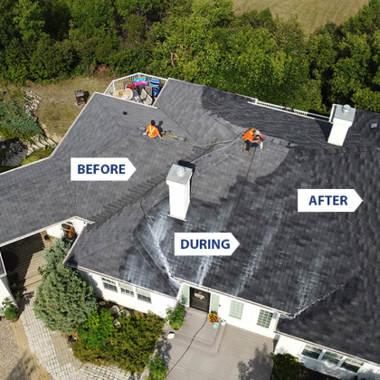 shingles before, during, and after